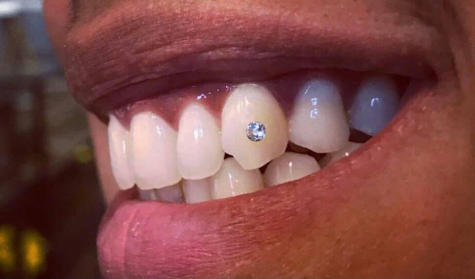 The Highest Quality of Tooth Gems Sparkle When You Smile